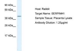 Image no. 1 for anti-Serpin Family H Member 1 (SERPINH1) (C-Term) antibody (ABIN2792207) (SERPINH1 anticorps  (C-Term))