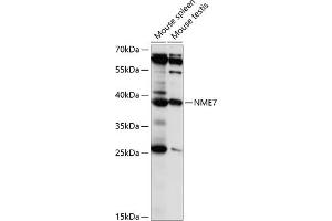 Western blot analysis of extracts of various cell lines, using NME7 antibody (ABIN7269055) at 1:1000 dilution.