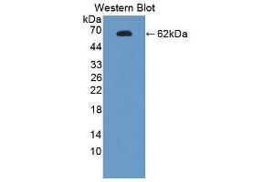 Western blot analysis of the recombinant protein. (Endonuclease G anticorps  (AA 1-294))