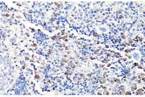Immunohistochemistry of paraffin-embedded Mouse spleen using S100A9 Polyclonal Antibody at dilution of 1:100 (40x lens). (S100A9 anticorps)