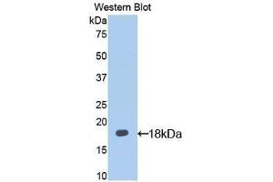 Detection of Recombinant IL13Ra1, Mouse using Polyclonal Antibody to Interleukin 13 Receptor Alpha 1 (IL13Ra1) (IL13 Receptor alpha 1 anticorps  (AA 28-171))