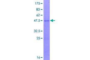 Image no. 1 for IMP3, U3 Small Nucleolar Ribonucleoprotein (IMP3) (AA 1-184) protein (GST tag) (ABIN1307877)