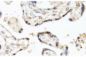Immunohistochemistry of paraffin-embedded Human placenta using KLF5 Polyclonal Antibody at dilution of 1:100 (40x lens). (KLF5 anticorps)