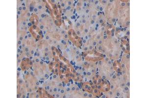 IHC-P analysis of kidney tissue, with DAB staining. (AFAP anticorps  (AA 352-572))