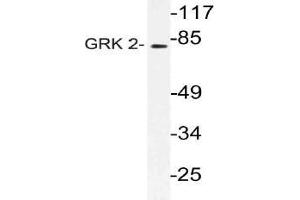 Western blot (WB) analysis of GRK 2 antibody in extracts from Jurkat cells. (GRK2 anticorps)