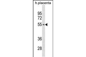 TARBP2 Antibody (N-term) ABIN2846967 western blot analysis in human placenta tissue lysates (35 μg/lane). (TARBP2 anticorps  (N-Term))