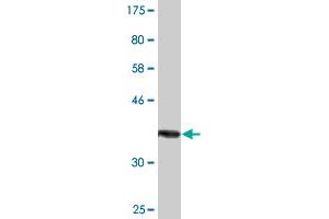 Western Blot detection against Immunogen (37.