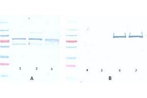 Western Blotting (WB) image for anti-V-Akt Murine Thymoma Viral Oncogene Homolog 1 (AKT1) (Ser473) antibody (ABIN400784) (AKT1 anticorps  (Ser473))