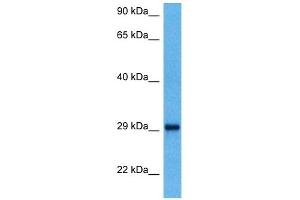 Host:  Mouse  Target Name:  YWHAQ  Sample Tissue:  Mouse Kidney  Antibody Dilution:  1ug/ml (14-3-3 theta anticorps  (N-Term))