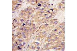 Image no. 3 for anti-SMAD Specific E3 Ubiquitin Protein Ligase 1 (SMURF1) (N-Term) antibody (ABIN357469)