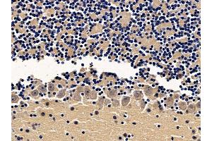 ABIN7094065 and ABIN7098109 at 1/100 staining mouse brain tissue by IHC-P. (AP2B1 anticorps  (N-Term))