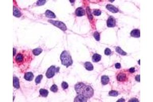 Anti-PTGFR antibody immunocytochemistry (ICC) staining of HEK293 human embryonic kidney cells transfected with PTGFR.