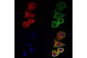 ABIN6259742 and ABIN6272985 staining Hela cells by IF/ICC. (ACSL4 anticorps  (N-Term))
