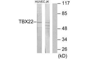 Western blot analysis of extracts from HUVEC cells and Jurkat cells, using TBX22 antibody. (T-Box 22 anticorps  (N-Term))
