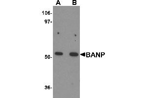 Western Blotting (WB) image for anti-Protein BANP (BANP) (Middle Region) antibody (ABIN1030879) (BANP anticorps  (Middle Region))