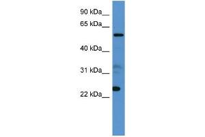 Human 721_B; WB Suggested Anti-CPNE9 Antibody Titration: 0. (CPNE9 anticorps  (C-Term))