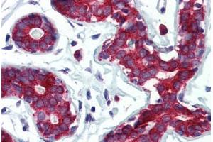 Human Breast (formalin-fixed, paraffin-embedded) stained with TPD52L1 antibody ABIN364314 at 5 ug/ml followed by biotinylated anti-mouse IgG secondary antibody ABIN481714, alkaline phosphatase-streptavidin and chromogen. (TPD52L1 anticorps)