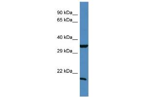 Western Blotting (WB) image for anti-TIMP Metallopeptidase Inhibitor 1 (TIMP1) (N-Term) antibody (ABIN2787966) (TIMP1 anticorps  (N-Term))