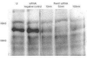 Total lysates (50ug per lane) from Hela cells untransfected (U) or transfected with negative siRNA control or Rent1 siRNAs of 10nm, 50nm to 100nm.