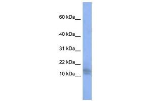 BRWD1 antibody used at 1 ug/ml to detect target protein. (BRWD1 anticorps  (N-Term))