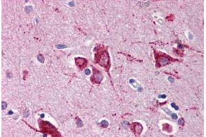 Human Brain, Cortex (formalin-fixed, paraffin-embedded) stained with RHEB antibody ABIN214467 at 5 ug/ml followed by biotinylated goat anti-rabbit IgG secondary antibody ABIN481713, alkaline phosphatase-streptavidin and chromogen. (RHEB anticorps)