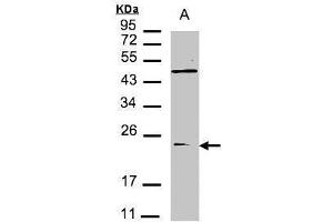WB Image Sample(30 μg of whole cell lysate) A:293T 12% SDS PAGE antibody diluted at 1:1500 (VPS29 anticorps  (C-Term))