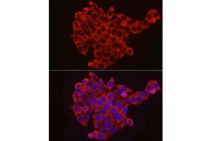 Immunofluorescence analysis of HeLa using EIF4B antibody (ABIN6127837, ABIN6140078, ABIN6140080 and ABIN6217245) at dilution of 1:25 (40x lens). (EIF4B anticorps  (AA 352-611))