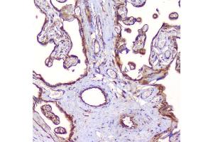 IHC analysis of RP2 using anti-RP2 antibody (ABIN6719513).
