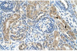 anti-Cysteine-Rich with EGF-Like Domains 1 (CRELD1) (C-Term) antibody
