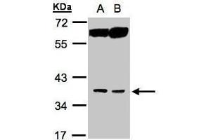 WB Image Sample(30 ug whole cell lysate) A:MOLT4 , B:Raji , 10% SDS PAGE antibody diluted at 1:1000 (ACOT8 anticorps)