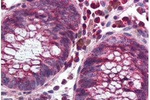 Human Colon (formalin-fixed, paraffin-embedded) stained with NOX1 antibody ABIN297329 at 10 ug/ml followed by biotinylated goat anti-rabbit IgG secondary antibody ABIN481713, alkaline phosphatase-streptavidin and chromogen. (NOX1 anticorps  (C-Term))