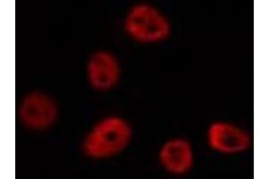 ABIN6275690 staining HUVEC by IF/ICC. (ZNF292 anticorps  (Internal Region))