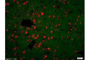 Formalin-fixed and paraffin-embedded rat brain labeled with Anti-KLK14 Polyclonal Antibody, Unconjugated (ABIN676058) 1:200, overnight at 4°C, The secondary antibody was Goat Anti-Rabbit IgG, Cy3 conjugated used at 1:200 dilution for 40 minutes at 37°C.