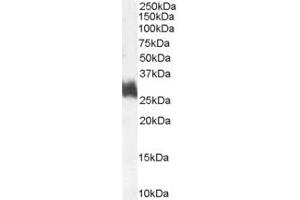 ABIN185649 (1µg/ml) staining of Human Bone Marrow lysate (35µg protein in RIPA buffer). (FOSL1 anticorps  (Internal Region))
