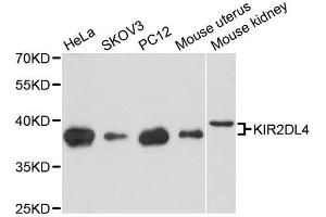 Western blot analysis of extracts of various cell lines, using KIR2DL4 antibody. (KIR2DL4/CD158d anticorps  (AA 22-242))