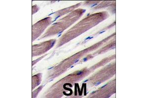 Formalin-fixed and paraffin-embedded human skeletal muscle tissue reacted with LATS2 polyclonal antibody  , which was peroxidase-conjugated to the secondary antibody, followed by DAB staining . (LATS2 anticorps  (AA 195-224))