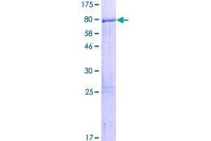 Image no. 1 for Leucine Rich Repeat Containing 6 (LRRC6) (AA 1-466) protein (GST tag) (ABIN1309791)