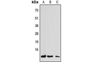 Western blot analysis of CCL7 expression in HEK293T (A), Raw264.