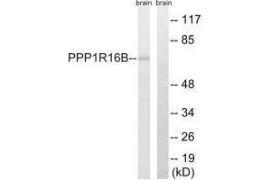 Western blot analysis of extracts from mouse brain cells, using PPP1R16B antibody. (PPP1R16B anticorps)