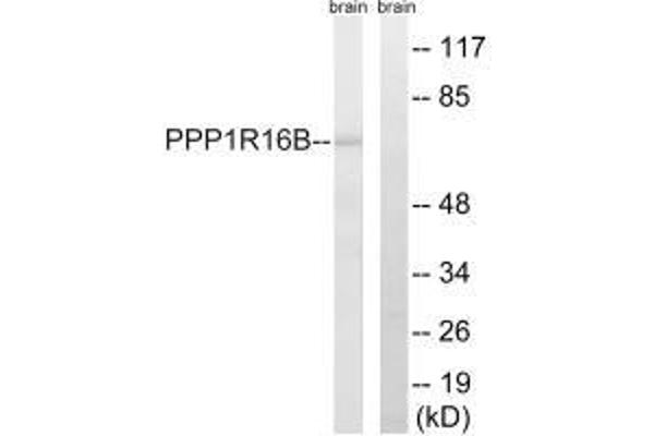 PPP1R16B anticorps