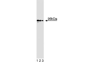 Western blot analysis of p96 on BC3H1 lysate. (DAB2 anticorps  (AA 31-45))