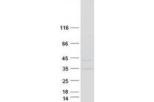 Validation with Western Blot