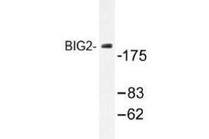 Image no. 1 for anti-ADP-Ribosylation Factor Guanine Nucleotide-Exchange Factor 2 (Brefeldin A-Inhibited) (ARFGEF2) antibody (ABIN317822) (ARFGEF2 anticorps)