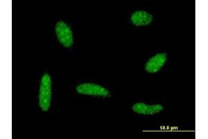 Immunofluorescence of monoclonal antibody to MEF2BNB on HeLa cell . (MEF2BNB anticorps  (AA 1-119))
