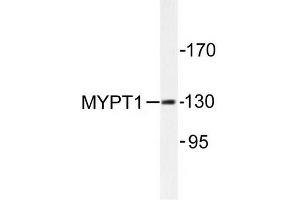 Image no. 1 for anti-Myosin Phosphatase, Target Subunit 1 (PPP1R12A) antibody (ABIN272043)