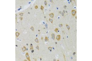 Immunohistochemistry of paraffin-embedded mouse brain using NEU1 antibody (ABIN5973721) at dilution of 1/100 (40x lens). (NEU1 anticorps)