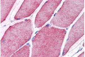 Human Skeletal Muscle: Formalin-Fixed, Paraffin-Embedded (FFPE) (TCTN2 anticorps  (C-Term))