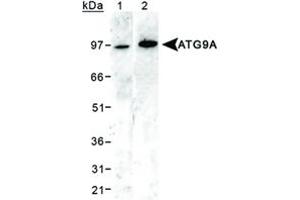 Western blot analysis of ATG9A in 293 cell lysates using ATG9A polyclonal antibody . (ATG9A anticorps  (AA 750-839))