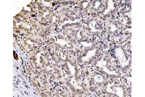 IHC analysis of RAX2 using anti-RAX2 antibody (ABIN7602913). (RAX2 anticorps  (C-Term))