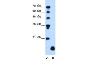 WB Suggested Anti-PLP2 Antibody Titration:  1. (PLP2 anticorps  (Middle Region))